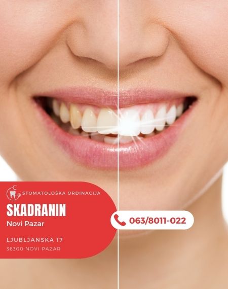 Stomatološka ordinacija Skadranin Novi Pazar